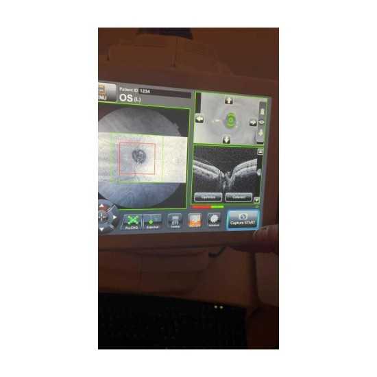 OCT Topcon Maestro 2 Year 2022 OCT Topcon Maestro 2 Year 2022