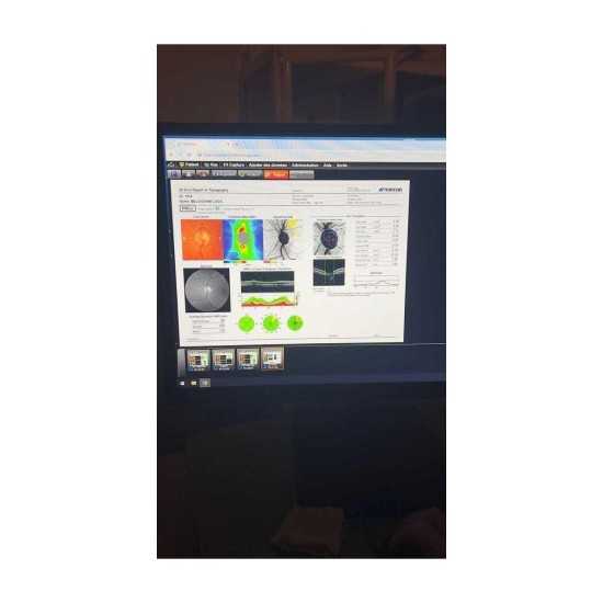 OCT Topcon Maestro 2 Year 2022 OCT Topcon Maestro 2 Year 2022