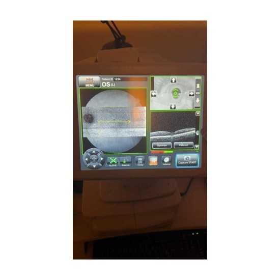 OCT Topcon Maestro 2 Year 2022 OCT Topcon Maestro 2 Year 2022