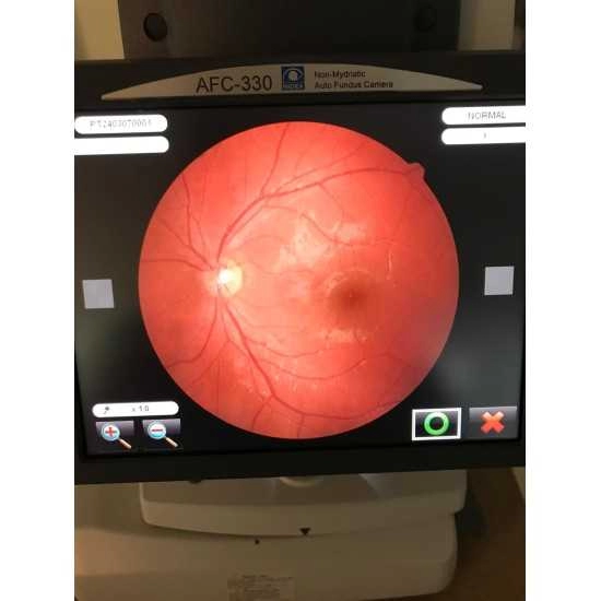 Fundus Camera Nidek AFC-330