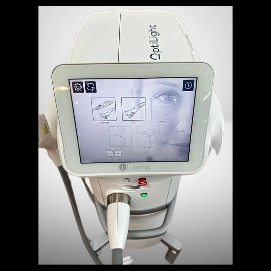 Optilight Dry Eye Lumenis Optilight Dry Eye Lumenis