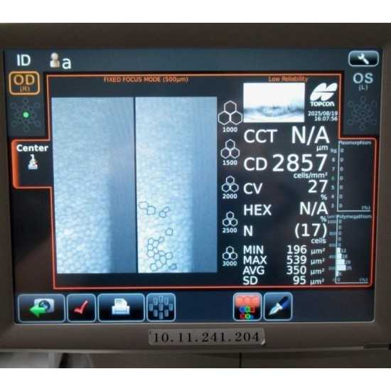 Endothelial Microscope Topcon SP-1P