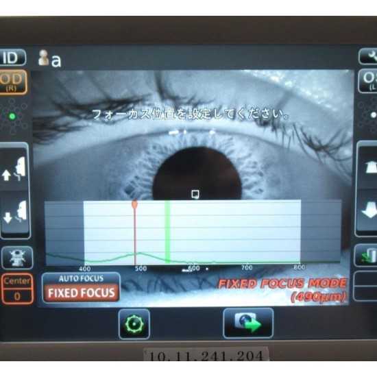Endothelial Microscope Topcon SP-1P