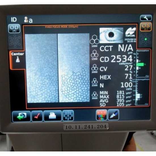 Endothelial Microscope Topcon SP-1P