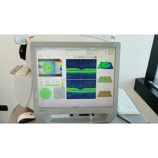 OCT Zeiss Cirrus 500 Year 2013 OCT Zeiss Cirrus 500 Year 2013