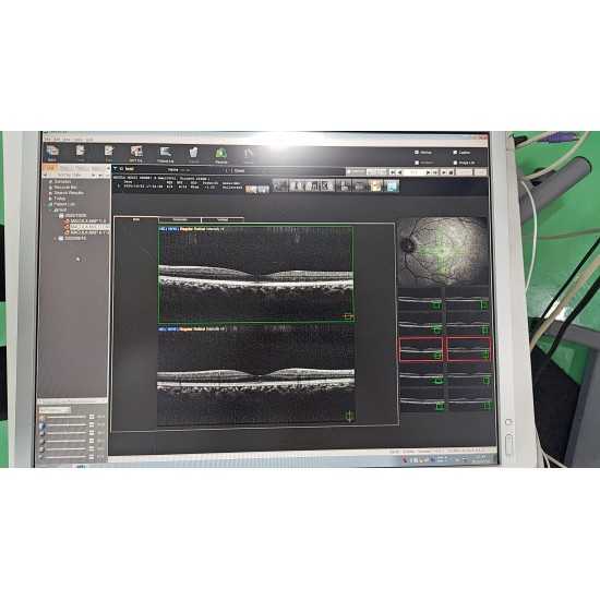 OCT Nidek RS-3000 Advance OCT Nidek RS-3000 Advance