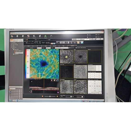 OCT Nidek RS-3000 Advance OCT Nidek RS-3000 Advance