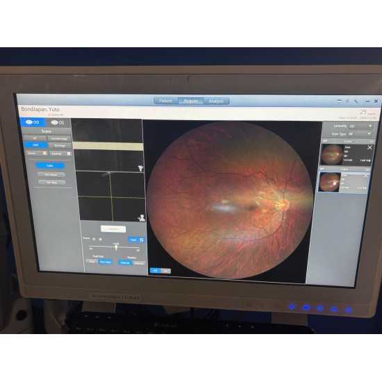 Fundus Camera Zeiss Clarus 500